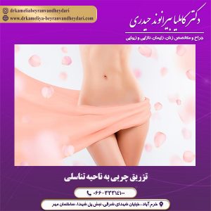 تزریق چربی به ناحیه تناسلی