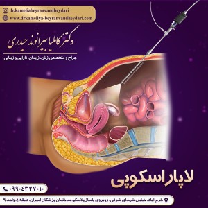 لاپاراسکوپی - دکتر بیرانوند