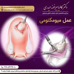 میومکتومی - دکتر بیرانوند