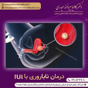 درمان ناباروری با iui در خرم آباد - دکتر بیرانوند