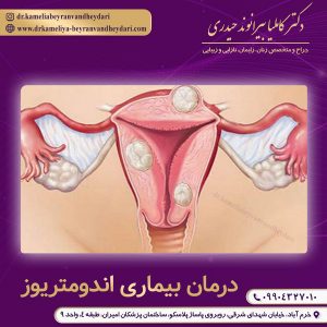 درمان بیماری اندومتریوز در خرم آباد - دکتر بیرانوند