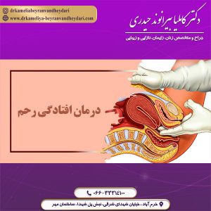 درمان افتادگی رحم