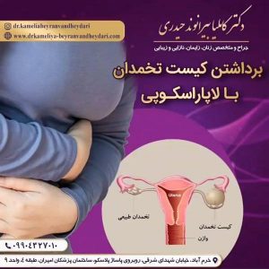 لاپاراسکوپی - دکتر بیرانوند