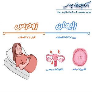 زایمان زودرس - دکتر کاملیا بیرانوند حیدری